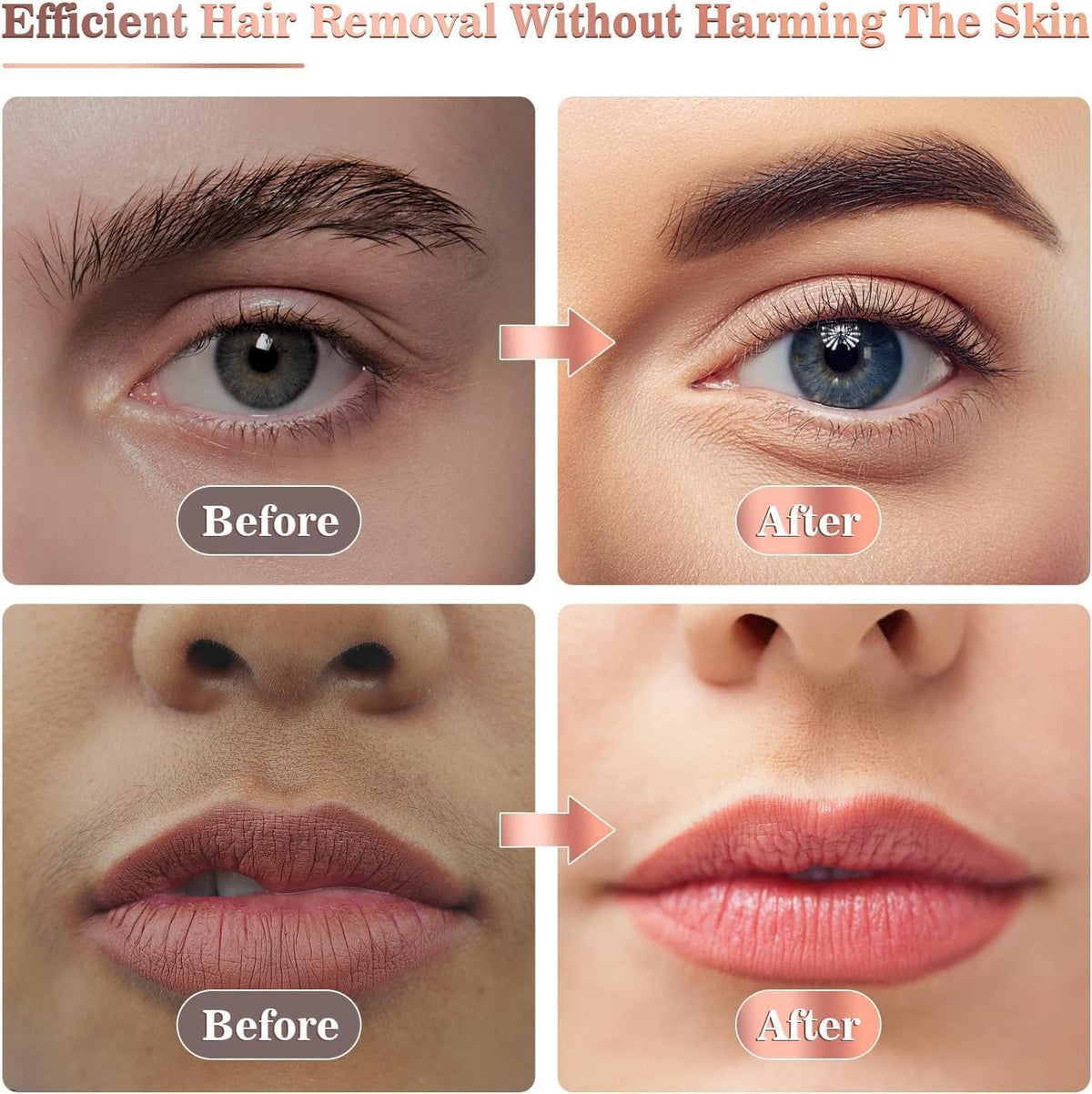 Facial Hair Remover